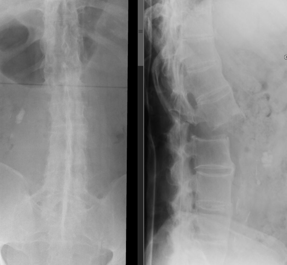 Case 16